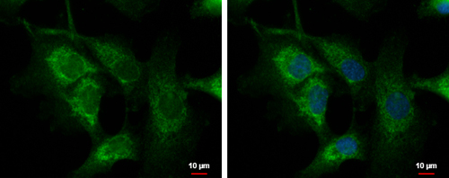 C1orf74 antibody [N2C3] detects C1orf74 protein at cytoplasm by immunofluorescent analysis.Sample: U87-MG cells were fixed in 4% paraformaldehyde at RT for 15 min.Green: C1orf74 protein stained by C1orf74 antibody [N2C3] diluted at 1:1000.Blue: Hoechst 33342 staining.