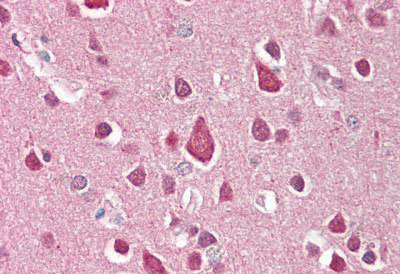 Anti-FXYD2 antibody IHC staining of human brain, cortex. Immunohistochemistry of formalin-fixed, paraffin-embedded tissue after heat-induced antigen retrieval.