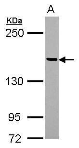 Sample (50 ug of whole cell lysate) A: mouse brain 5% SDS PAGE diluted at 1:1000