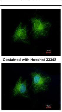 Immunofluorescence analysis of methanol-fixed HeLa, using CCDC28B antibody at 1:500 dilution.