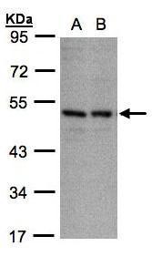 Sample(30 ug whole cell lysate) A:A431 B:H1299 10% SDS PAGE diluted at 1:1000