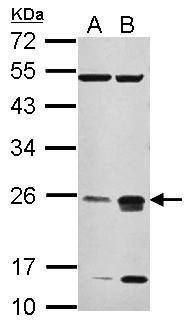 Sample (20 ug of whole cell lysate) A: HeLa B: HeLa cytoplasm 12% SDS PAGE diluted at 1:1000