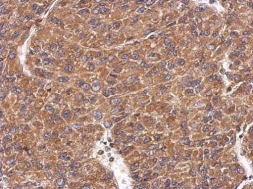 Immunohistochemical analysis of paraffin-embedded U87 xenograft, using CHMP4C antibody at 1:500 dilution.