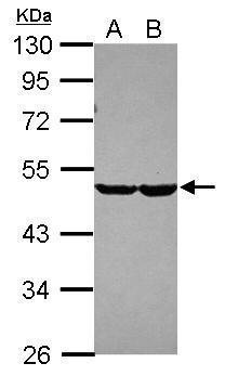 Sample (30 ug of whole cell lysate) A: NT2D1 B: IMR32 10% SDS PAGE Diluted at 1:3000