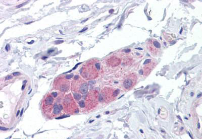 Anti-CNPPD1 / C2orf24 antibody IHC of human small intestine, submucosal plexus. Immunohistochemistry of formalin-fixed, paraffin-embedded tissue after heat-induced antigen retrieval. Antibody concentration 10 ug/ml.