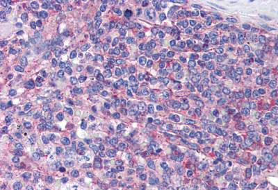 Anti-CNPPD1 / C2orf24 antibody IHC of human spleen. Immunohistochemistry of formalin-fixed, paraffin-embedded tissue after heat-induced antigen retrieval. Antibody concentration 10 ug/ml.