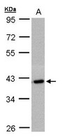Sample(30 g of whole cell lysate). A: Raji. 7.5% SDS PAGE. C2orf24 antibody diluted at 1:1000.