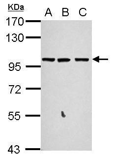 Sample (30 ug of whole cell lysate) A: A549 B: H1299 C: MCF-7 7.5% SDS PAGE diluted at 1:1000