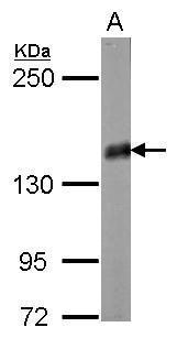 Sample (20 ug of whole cell lysate) A: mouse brain 5% SDS PAGE diluted at 1:10000