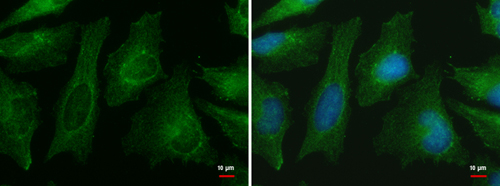 LOC27013 antibody [N1C1] detects LOC27013 protein at cytoplasm by immunofluorescent analysis.Sample: HeLa cells were fixed in ice-cold MeOH for 5 min.Green: LOC27013 protein stained by LOC27013 antibody [N1C1] diluted at 1:500.Blue: Hoechst 33342 staining.