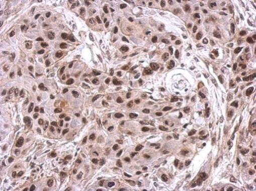 Immunohistochemical analysis of paraffin-embedded Cal27 xenograft, using NIP30 antibody at 1:200 dilution.