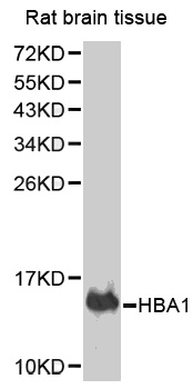 Western blot analysis of extracts of rat brain tissue, using HBA1 antibody.