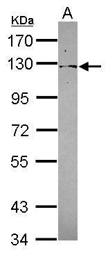 Sample (30 ug of whole cell lysate) A: A431 7.5% SDS PAGE diluted at 1:1000