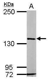 Sample (50 ug of whole cell lysate) A: mouse brain 5% SDS PAGE diluted at 1:1000