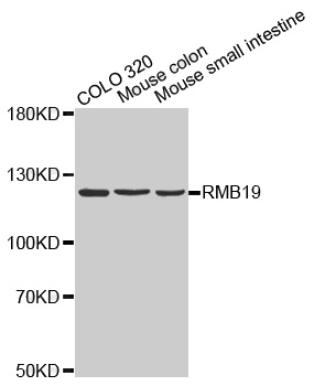 Western blot analysis of extracts of various cell lines, using RBM19 antibody.