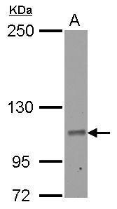 Sample (30 ug of whole cell lysate) A: HepG2 5% SDS PAGE Diluted at 1:1000
