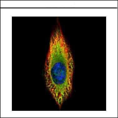 Confocal immunofluorescence analysis (Olympus FV10i) of methanol-fixed HeLa, using RIN2 antibody (Green) at 1:500 dilution. Alpha-tubulin filaments were labeled (Red) at 1:2000.
