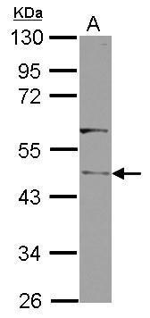 Sample (30 ug of whole cell lysate) A: IMR32 10% SDS PAGE diluted at 1:1000