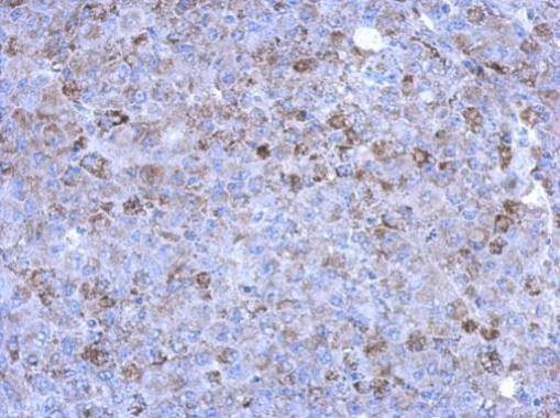 Immunohistochemical analysis of paraffin-embedded Hela xenograft, using ORNT1 antibody at 1:500 dilution.