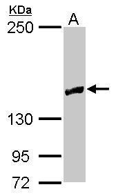 Sample (30 ug of whole cell lysate) A: NT2D1 5% SDS PAGE Diluted at 1:2000