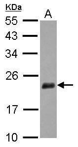 Sample (30 ug of whole cell lysate) A: IMR32 12% SDS PAGE diluted at 1:1000