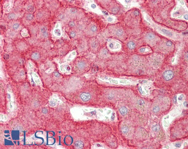Anti-ASGR1 / ASGPR antibody IHC staining of human liver. Immunohistochemistry of formalin-fixed, paraffin-embedded tissue after heat-induced antigen retrieval. Antibody LS-B10691 dilution 1:100.