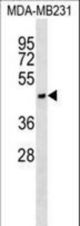 ASGR1 Antibody western blot of MDA-MB231 cell line lysates (35 ug/lane). The ASGR1 antibody detected the ASGR1 protein (arrow).