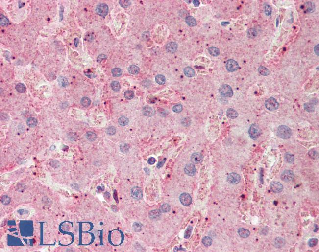 Anti-ASGR2 antibody IHC staining of human liver. Immunohistochemistry of formalin-fixed, paraffin-embedded tissue after heat-induced antigen retrieval. Antibody LS-B9655 concentration 5 ug/ml.