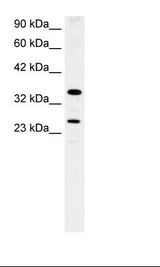 Fetal Lung Lysate