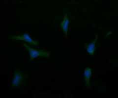 Immunofluorescent staining of HeLa cells using anti-ASGR2 mouse monoclonal antibody.