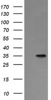 HEK293T cells were transfected with the pCMV6-ENTRY control (Left lane) or pCMV6-ENTRY ASGR2 (Right lane) cDNA for 48 hrs and lysed. Equivalent amounts of cell lysates (5 ug per lane) were separated by SDS-PAGE and immunoblotted with anti-ASGR2.