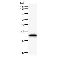 Western blot analysis of immunized recombinant protein, using anti-ASH1L monoclonal antibody.