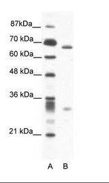 A: Marker, B: Jurkat Cell Lysate