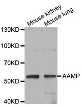 Western blot analysis of extracts of various cell lines, using AAMP antibody.