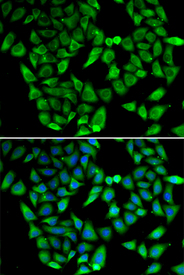 Immunofluorescence blot of HeLa cell using ASIP antibody. Blue: DAPI for nuclear staining.