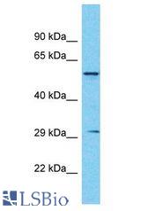 ASMT / HIOMT antibody Western Blot of Fetal Kidney. Antibody dilution: 1 ug/ml.