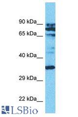 ASMT / HIOMT antibody Western Blot of Jurkat. Antibody dilution: 1 ug/ml.