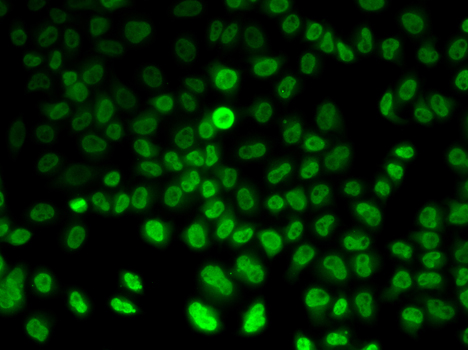 Immunofluorescence blot of HeLa cell using ASMT antibody.