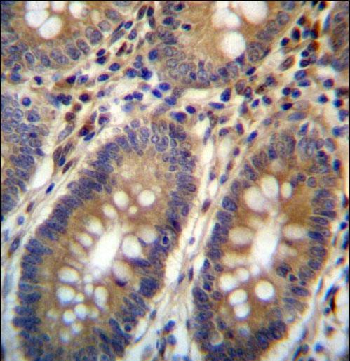 ASMTL Antibody immunohistochemistry of formalin-fixed and paraffin-embedded human colon tissue followed by peroxidase-conjugated secondary antibody and DAB staining.
