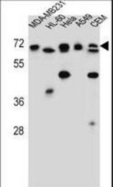 ASMTL Antibody western blot of MDA-MB231,HL-60,HeLa,A549,CEM cell line lysates (35 ug/lane). The ASMTL antibody detected the ASMTL protein (arrow).