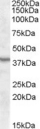 Antibody (1 ug/ml) staining of Mouse Kidney lysate (35 ug protein in RIPA buffer) with (B) and without (A) blocking with the immunizing peptide. Primary incubation was 1 hour. Detected by chemiluminescence
