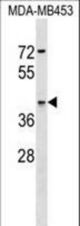 ARSA Antibody western blot of MDA-MB453 cell line lysates (35 ug/lane). The ARSA antibody detected the ARSA protein (arrow).