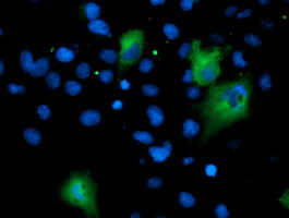 Anti-ASNS mouse monoclonal antibody immunofluorescent staining of COS7 cells transiently transfected by pCMV6-ENTRY ASNS.