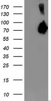 HEK293T cells were transfected with the pCMV6-ENTRY control (Left lane) or pCMV6-ENTRY ASNS (Right lane) cDNA for 48 hrs and lysed. Equivalent amounts of cell lysates (5 ug per lane) were separated by SDS-PAGE and immunoblotted with anti-ASNS.