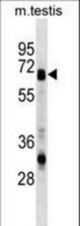 ASNS Antibody western blot of mouse testis tissue lysates (35 ug/lane). The ASNS antibody detected the ASNS protein (arrow).