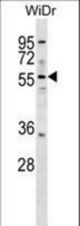 ASNS Antibody western blot of WiDr cell line lysates (35 ug/lane). The ASNS antibody detected the ASNS protein (arrow).