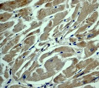 IHC of paraffin-embedded human muscle tissue using anti-Asparagine Synthetase antibody.