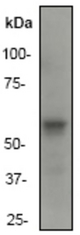 Western blot analysis on K562 cell lysate using anti-Asparagine Synthetase antibody, dilution 1:2000.