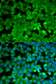 Immunofluorescence analysis of A549 cell using ASNS antibody. Blue: DAPI for nuclear staining.