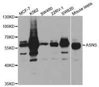 Western blot analysis of extracts of various cell lines, using ASNS antibody.